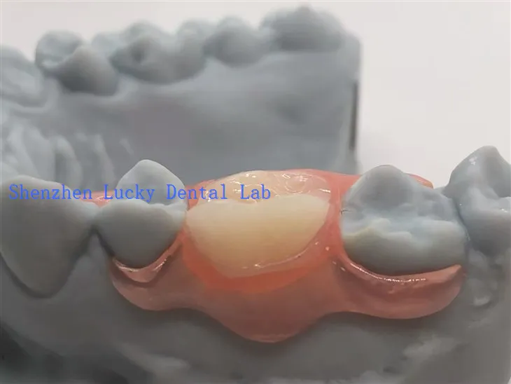 3D Print Dental Partial Flexible Denture With Valplast Clasp Made in China