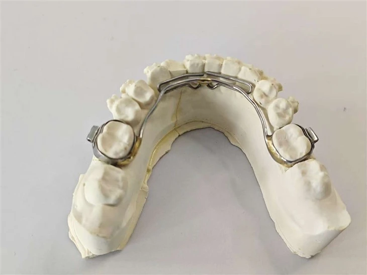 Dental Retainer Lingual Arch