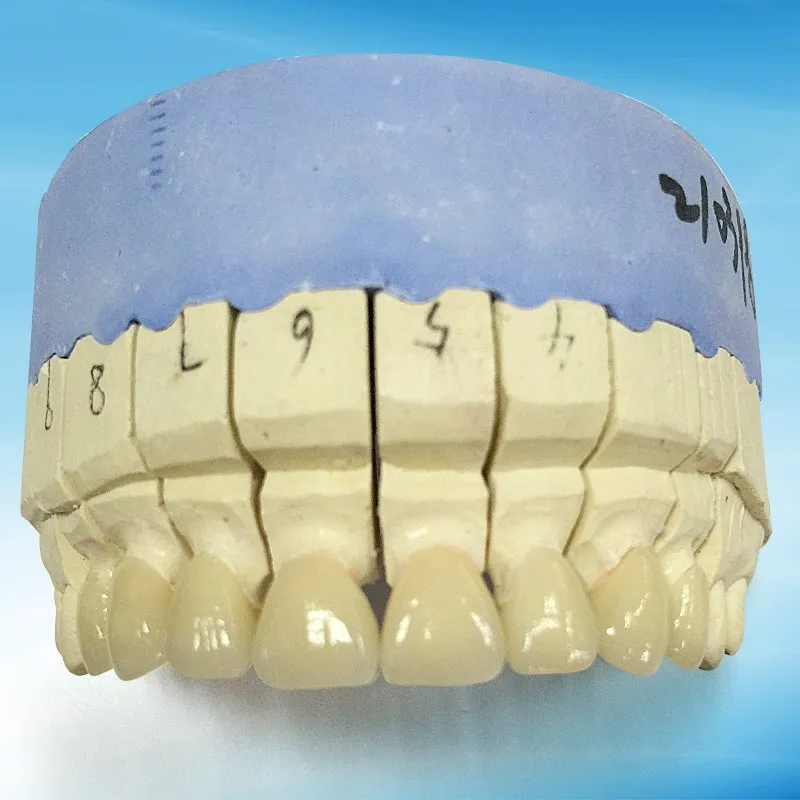 Excellent Dental PFM Ni Cr Crowns Bridge