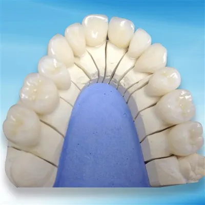 วัสดุเซอร์โคเนียสำหรับงานทันตกรรมมีข้อกำหนดในการบำรุงรักษาอย่างไรบ้าง?