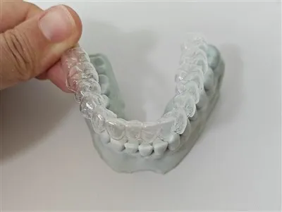 เครื่องมือจัดฟันแบบใสทำงานอย่างไร?