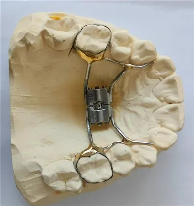 มีการศึกษาค้นคว้าวิจัยเกี่ยวกับฟันปลอมแบบถอดได้หรือไม่?